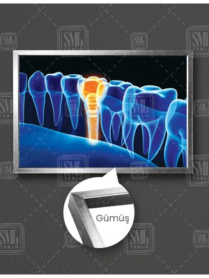 SML Tablo Dişçi Diş Hekimi Ofisi Ağız ve Diş Sağlığı Dentist Yatay Çerçeveli Kanvas Tablo