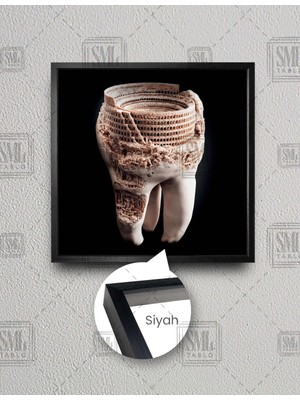 SML Tablo Diş Muayanehane Dental Sağlık Roma Kolezyum Kare Çerçeveli Kanvas Tablo