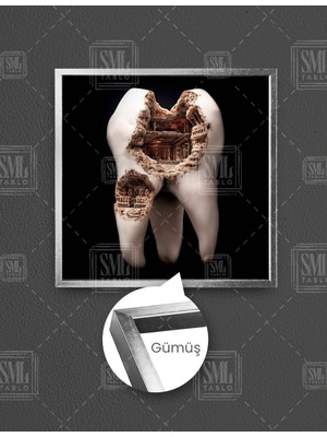 SML Tablo Diş Muayanehane Dental Sağlık Kare Çerçeveli Kanvas Tablo