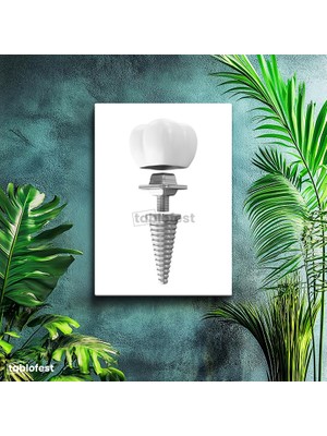 Tablofest Dikey Kanvas Tablo Dental Implant Parçaları Diş Hekimi Tablosu Ev Ofis Duvar Dekoru