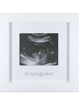 Kazan Hobi Fufizu Ilk Fotoğrafım Bebek Ultrason Çerçevesi - Bebek Odası Resim Anı Çerçevesi
