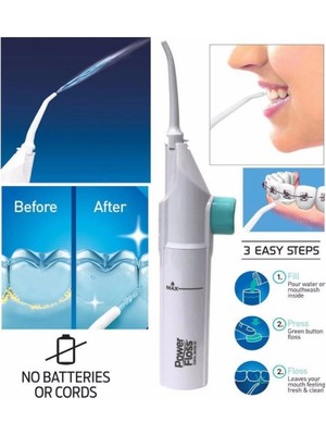 Portatif Tasarım Power Floss Mekanik Diş ve Ağız Temizleme Aleti ( Lisinya )
