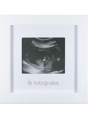 Ozka Concept Fufi̇zu Ilk Fotoğrafım Bebek Ultrason Çerçevesi - Bebek Odası Resim Anı Çerçevesi