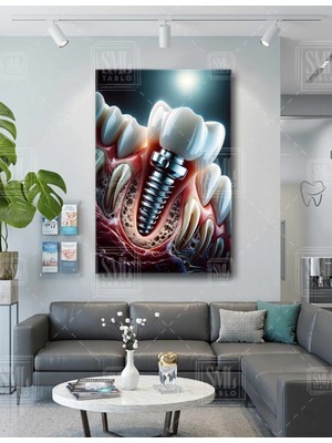 SML Tablo Diş Kanalı Implant Tedavisi Diş Kliniği Polikliniği Tabibi Ağız Dişçi Dekor Dikey Kanvas Tablo
