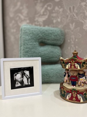 Empressco Fotoğraf Çerçevesi 3 Lü Kendinden Yapışkanlı Fotoğraf Sök Tak Lıpaket Pvc Li