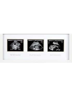 AKS Pearhead 87038 Trimester Sonogram Frame Deluxe, Fotoğraf Çerçevesi Için Üç Ultraschallaufnahmen, Beyaz