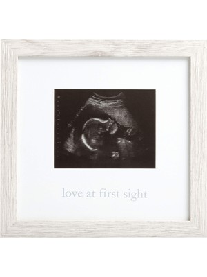 Sh Ticaret Kate & Milo Rustik Sonogram Ilk Görüşte Aşk Çerçevesi, Ebeveyn Hediyesi Bekleniyor, Ultrason Resim
