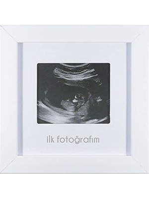 Mythriva Ilk Fotoğrafım Bebek Ultrason Çerçevesi - Bebek Odası Resim Anı Çerçevesi