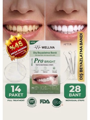 Diş Beyazlatma Bandı, Profesyonel Beyazlık, 14 Paket-28 Bant Daha Beyaz ve Parlak Dişler Için Pratik Çözüm