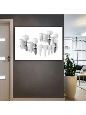 Şehzat Design Ağız ve Diş Sağlığı Polikliniği Tabloları Dekoratif Diş, Dekoratif Dişçi, Dişçi Dekorasyonu