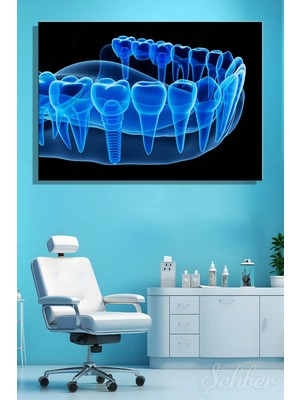Şehzat Design Alt Çene Dental Implantları Yatay Kanvas Tablo Tekli Ağız Diş Sağlığı Dişçi Poliklinik Hastane 3423