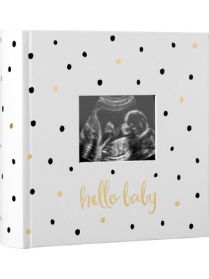 Str Store Hello Baby Fotoğraf Albümü, Yeni ve Bekleyen Ebeveynler Için Bebek Kitabı Hatırası, Cinsiyetsiz Bebek Aksesuarı, 200 Fotoğraf Tutar, Siyah ve Altın Puantiyeli