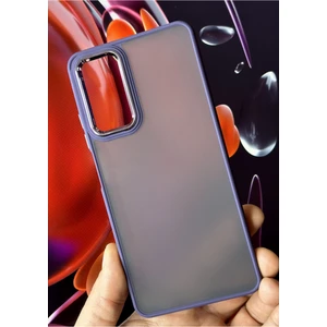 Xiaomi Redmi Note 10 Pro Kılıf Metal Çerçeve Hassas Butonlu Renkli Buzlu Şeffaf Transparan Kapak