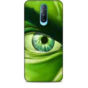 Oppo RX17 Neo Kılıf Caliburn 29 Hulk Göz Makro Leke Tutmaz Kapak