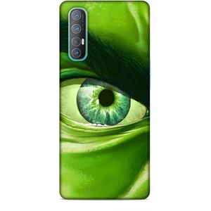 Oppo Reno 3 Pro Kılıf Caliburn 29 Hulk Göz Makro Leke Tutmaz Kapak