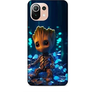 Xiaomi 11 Lite 5g Kılıf Caliburn 26 Bebek Groot Soft Kapak