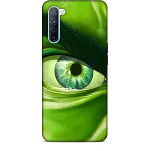 Oppo Reno 3 Kılıf Caliburn 29 Hulk Göz Makro Leke Tutmaz Kapak
