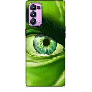 Oppo Reno 5 Pro Kılıf Caliburn 29 Hulk Göz Makro Leke Tutmaz Kapak