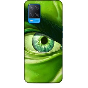 Oppo A54 Kılıf Caliburn 29 Hulk Göz Makro Leke Tutmaz Kapak