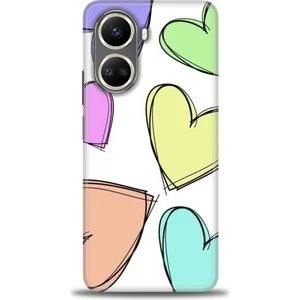 Glory Aksesuar Huawei Nova 10 Se Uyumlu Kılıf Hd Kalite Desenli  Baskılı Kılıf - G (15)