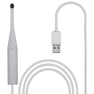 Xin Yue Zhang 2mp 720P Intraoral Dental Kamera Endoskop 6led USB - Beyaz (Yurt Dışından)