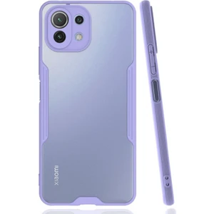 Xiaomi Mi 11 Lite Uyumlu Platin Seri Arka Koruma Kılıf - Lila