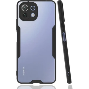 Xiaomi Mi 11 Lite Uyumlu Platin Seri Arka Koruma Kılıf