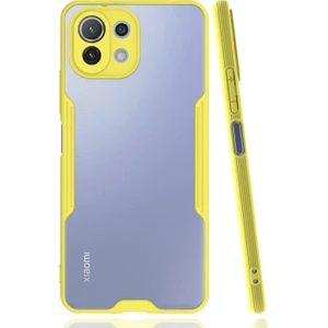 Xiaomi Mi 11 Lite Uyumlu Platin Seri Arka Koruma Kılıf