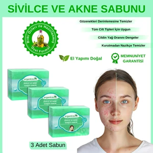 Doğal Akne Ve Sivilce Karşıtı Sabun 140 Gr X 3 Adet Tüm Cilt Tipleri Için Natural Sabun