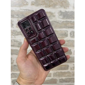 Vip Case Redmi Note 11 Pro ve Note 12 Pro |4g| Uyumlu Kabartmalı Dikiş Detaylı Baklava Desenli Parlak Vivid