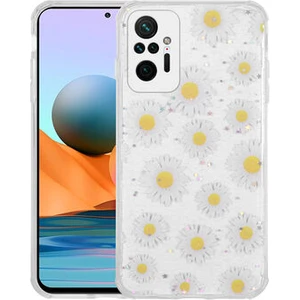 Redminote 10 Pro Kılıf Simli Desenli Kamera Korumalı Parlak Popy Kapak