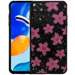 Redminote 11S Global Kılıf Simli Desenli Kamera Korumalı Parlak Popy Kapak