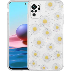 POCOM5S Kılıf Simli Desenli Kamera Korumalı Parlak Popy Kapak
