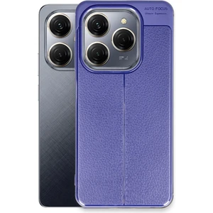 Tecno Spark 20 Pro 4g Kılıf Niss Deri Desen Silikon