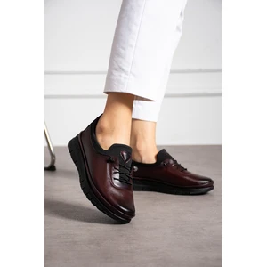 Kaof Shoes Kadın Bordo Klasik Ayakkabı Ortopedik Anne Ayakkabısı Anne Babet Ayakkabı Anne Kadın Günlük Ayakkabı
