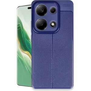 Xiaomi Redmi Note 13 Pro 4g Kılıf Deri Desli Kaliteli Silikon Kılıf