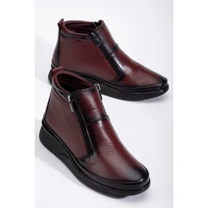 Dilimler Ayakkabı Deri Ortopedik Kadın Bot Bordo 2 Fermuarlı Dolgu Tabanlı