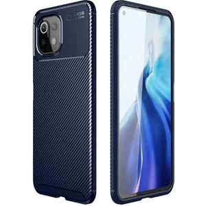 Xiaomi Mi 11 Lite Kılıf Karbon Desenli Şık Tamia Premium Silikon Kapak