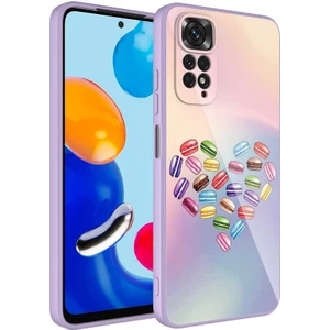 Xiaomi Redmi Note 11 Global Kılıf Kamera Korumalı Desenli Sert Silikon Zore Epoksi Kapak-No1