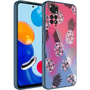 Xiaomi Redmi Note 11 Global Kılıf Kamera Korumalı Desenli Sert Silikon Epoksi Kapak-No3