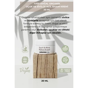 %100 Doğal Organik Uçuk ve Akne Acil Bakım Kremi 20 ml