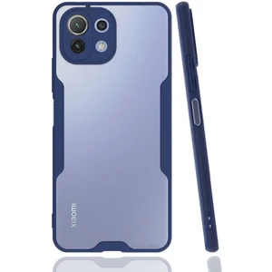 Heptek İletişim Xiaomi Mi 11 Lite Kılıf Parfe Kapak-Lacivert