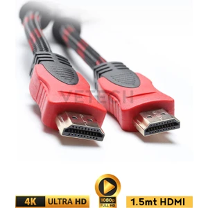 HDMI Kablo 1.5 Metre Örgü Sargılı Dayanıklı Full Hd Televizyon / Monitör / Tv HDMI Kablosu