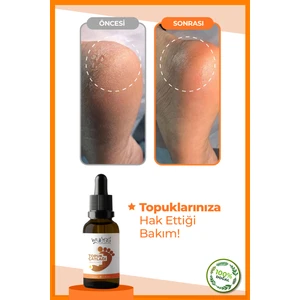 Ayak ve Topuk Çatlağı Bakım Yağı 30 ml