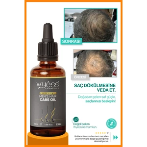 Erkek Saç Bakım Yağı - Saç Çıkarıcı & Besleyici Etki, E & A Vitaminli 50 ml