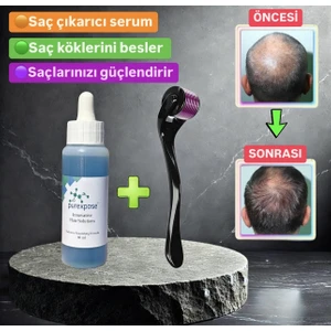 Saç Bakım bay /bayan saç çıkaran Losyonu ve 1 Adet Dermaroller
