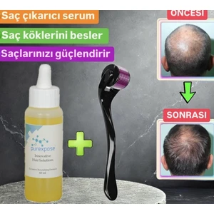 Saç Çıkaran Saç Losyonu Sarı - Dermoroller Armağan