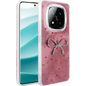 Redmi Note 14 Pro Plus Kılıf Kamera Korumalı Figürlü Zore Ponti Silikon Kapak - Açık Pembe