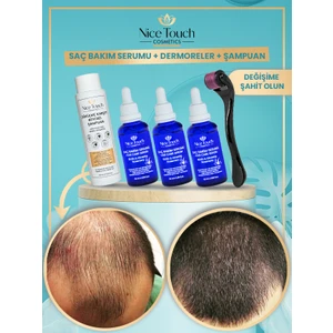 NİCE TOUCH KOZMETİK 3 Adet Saç Serum , Saç Vitamini+ 1 Adet Dermarroler+ 1 Adet Şampuan