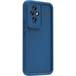 Honor 200 Kılıf Kamera Korumalı Ananas Silikon Kapak